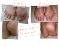 /album/boszipedikur/pedikur-png/